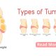 cirugía de abdominoplastia